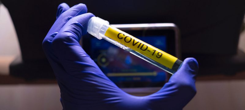 Argentina fue seleccionada para probar una vacuna contra el coronavirus