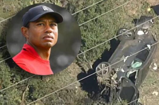 Tiger Woods sufrió fracturas en las piernas tras un grave accidente